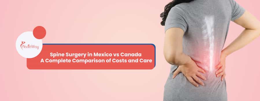 Spine Surgery in Mexico vs Canada