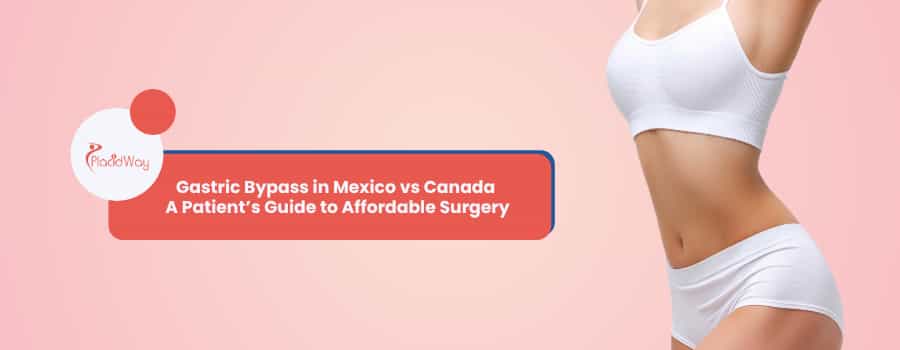 Gastric Bypass in Mexico vs Canada