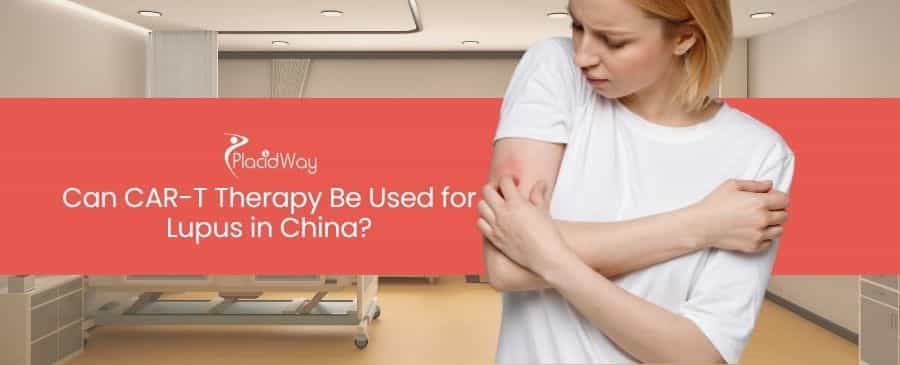 CAR-T Therapy for Lupus in China