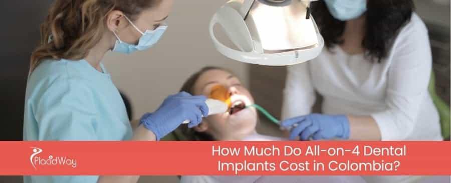 All on 4 Dental Implants Cost in Colombia