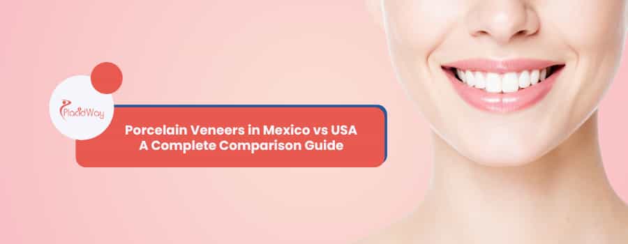 Veneers in Mexico