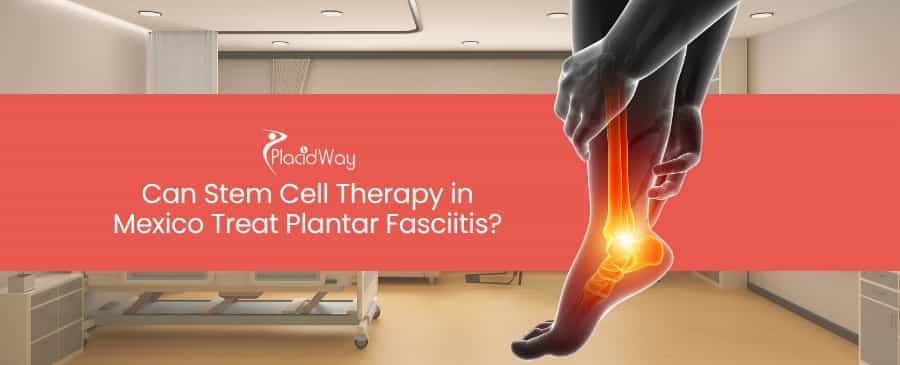Stem Cell Therapy in Mexico Treat Plantar Fasciitis