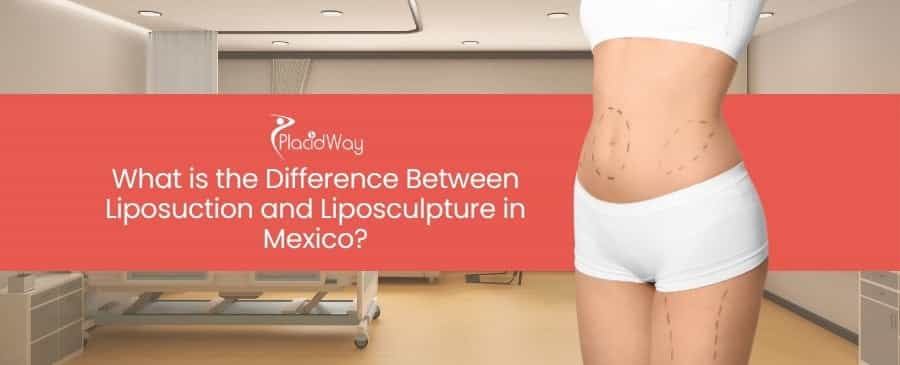 Liposuction and Liposculpture in Mexico