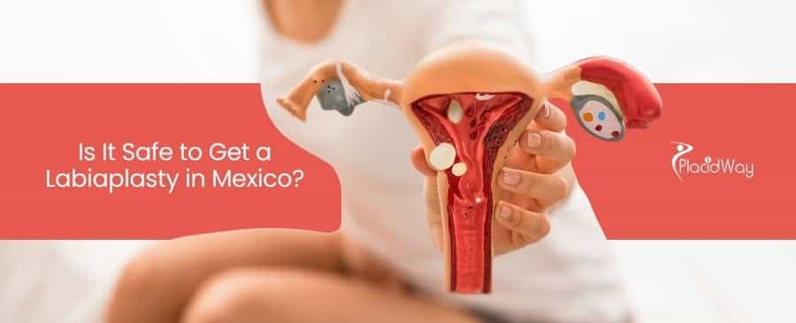 Labiaplasty in Mexico