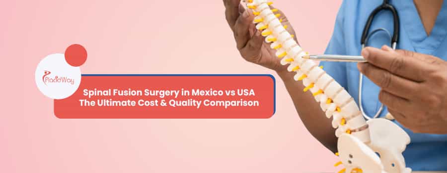 Spinal Fusion Surgery in Mexico vs USA