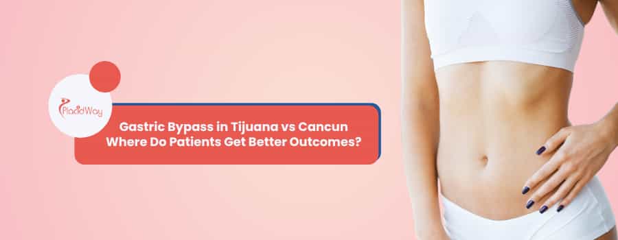 Gastric Bypass in Tijuana vs Cancun
