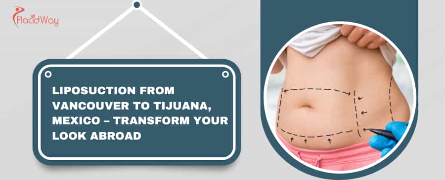 Liposuction from Vancouver to Tijuana, Mexico