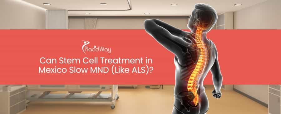 Stem Cell Treatment in Mexico Slow MND 