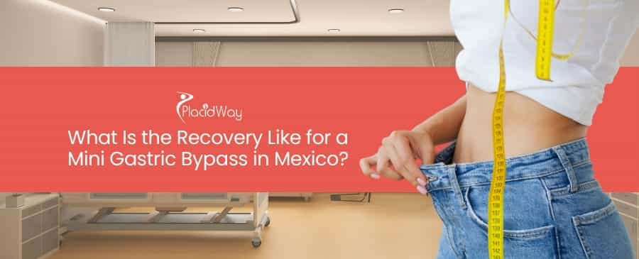 Mini Gastric Bypass in Mexico