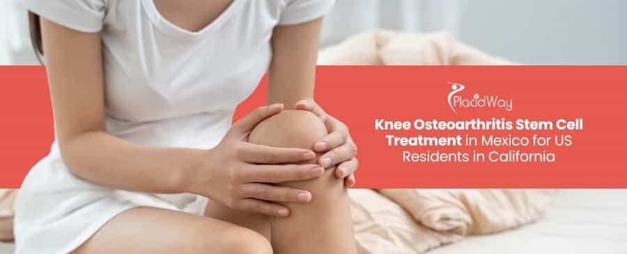 Knee Osteoarthritis Stem Cell Treatment in Mexico