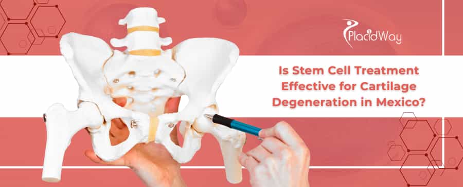stem cell for cartilage degeneration in Mexico