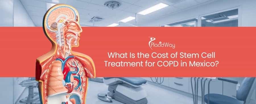 Stem Cell Treatment for COPD in Mexico