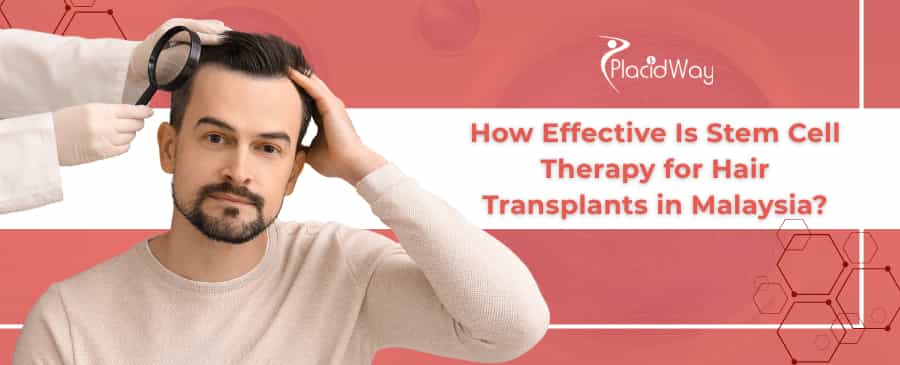 Stem Cell Therapy for Hair Loss in Malaysia