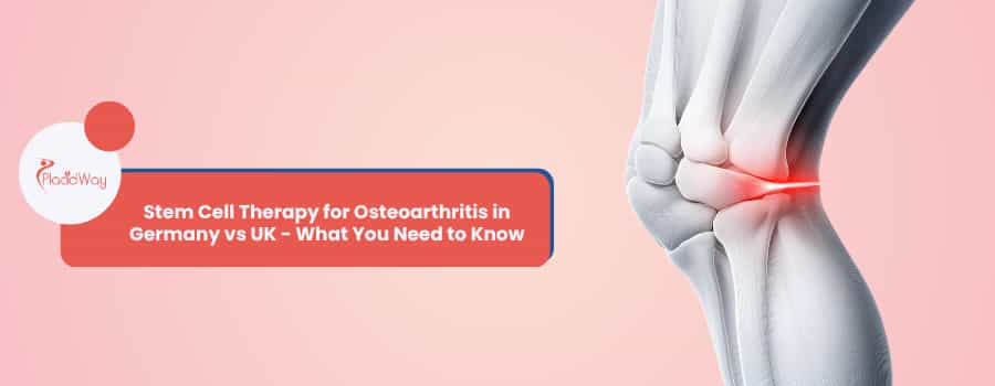 Stem Cell Therapy for Osteoarthritis in Germany vs UK