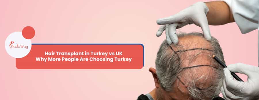 Hair Transplant in Turkey vs UK
