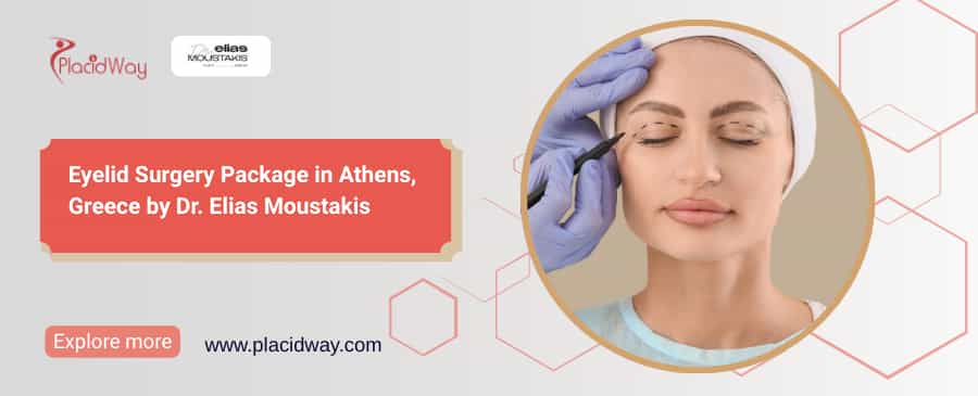 Eyelid Surgery Greece | Dr. Elias Moustakis
