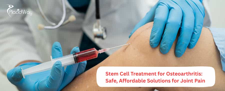 Stem Cell Treatment for Osteoarthritis
