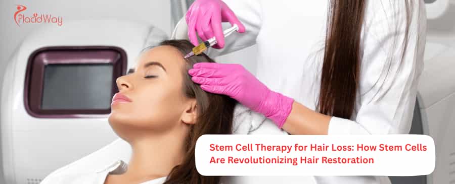 Stem Cell Therapy for Hair Loss