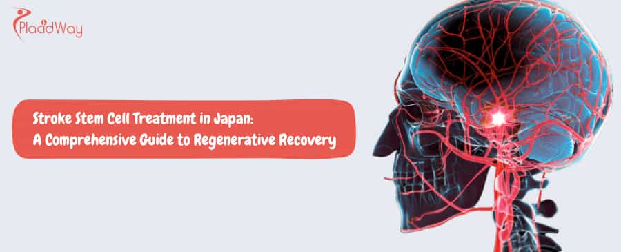 Stem Cell Therapy for Stroke Rehabilitation in Japan
