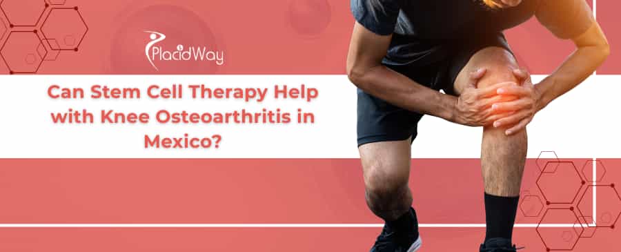 Stem Cell Therapy for Knee Osteoarthritis in Mexico