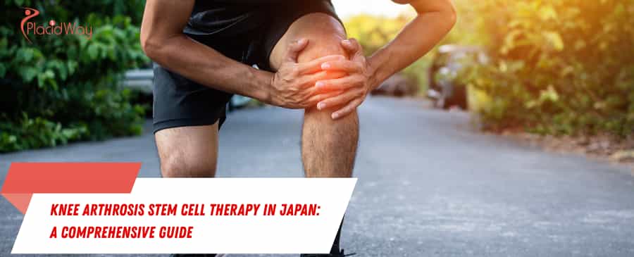 Knee Arthrosis Stem Cell Therapy in Japan
