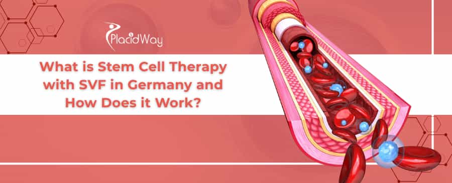 SVF Stem Cell Therapy in Germany