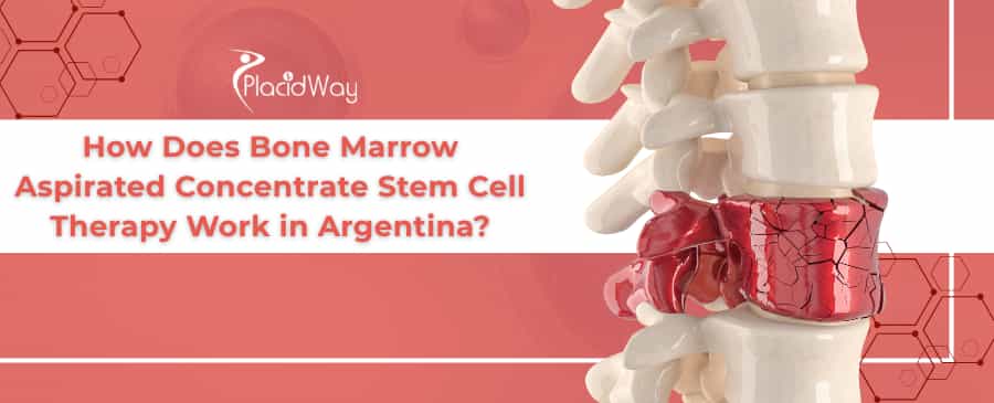 BMAC Stem Cell Therapy in Argentina