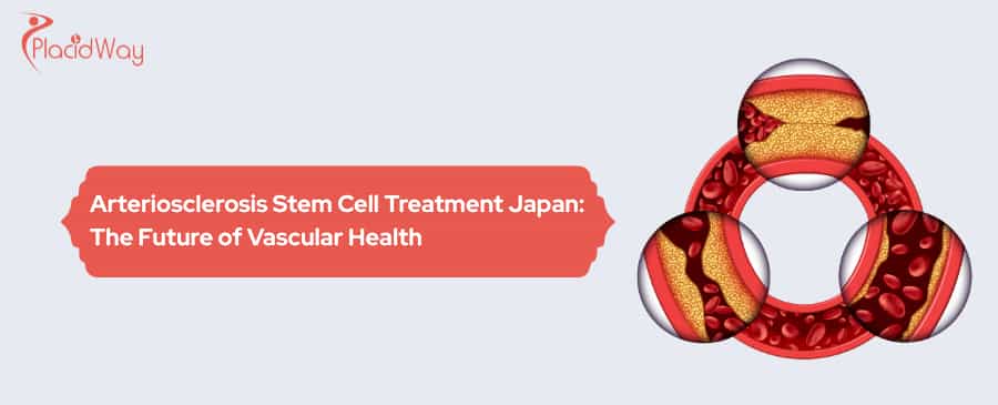 arteriosclerosis stem cell treatment Japan