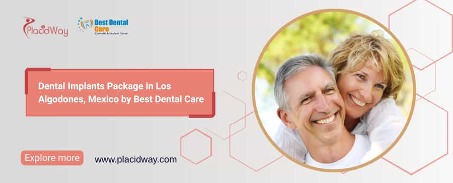 Dental Implants Los Algodones | Best Dental Care Mexico