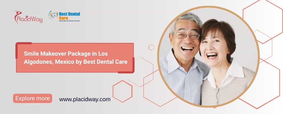 Smile Makeover Los Algodones | Best Dental Care
