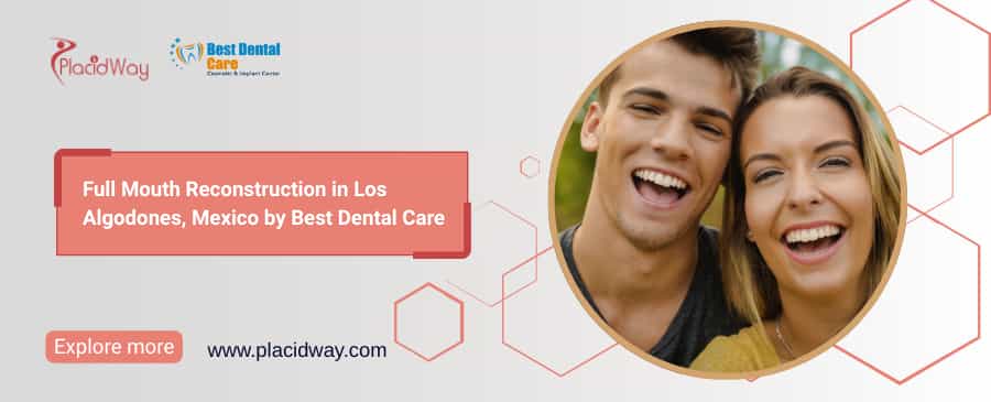 Full Mouth Reconstruction in Los Algodones: Affordable Smile Solution