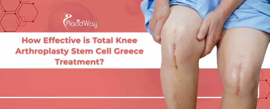 Total Knee Arthroplasty Stem Cell Therapy in Greece