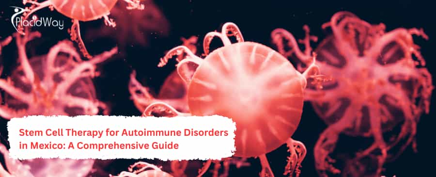Stem Cell Therapy for Autoimmune Disorders in Mexico