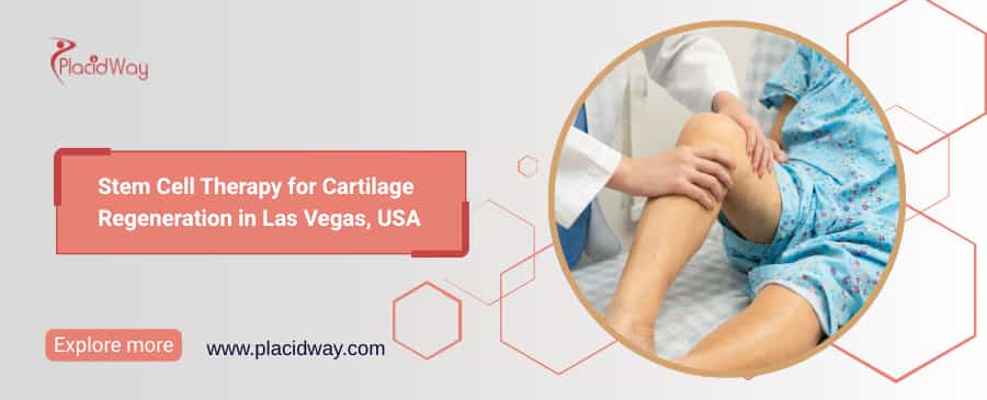 Stem Cell for Cartilage Regeneration in USA | PlacidWay