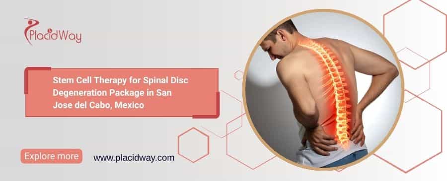 Spinal Disc Stem Cell Therapy Package in San Jose del Cabo
