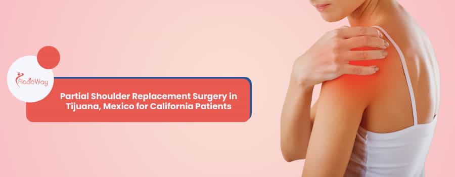 Partial Shoulder Replacement Surgery in Tijuana, Mexico for California Patients