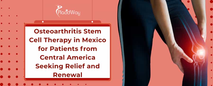 osteoarthritis stem cell therapy in Mexico
