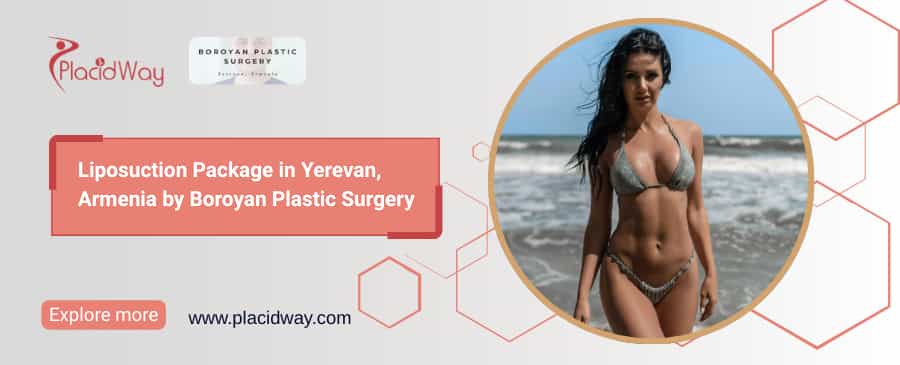 Liposuction Cost in Armenia | Boroyan Plastic Surgery