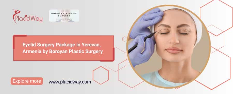 Eyelid Surgery in Armenia | Boroyan Plastic Surgery