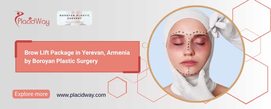 Brow Lift in Armenia | Boroyan Plastic Surgery