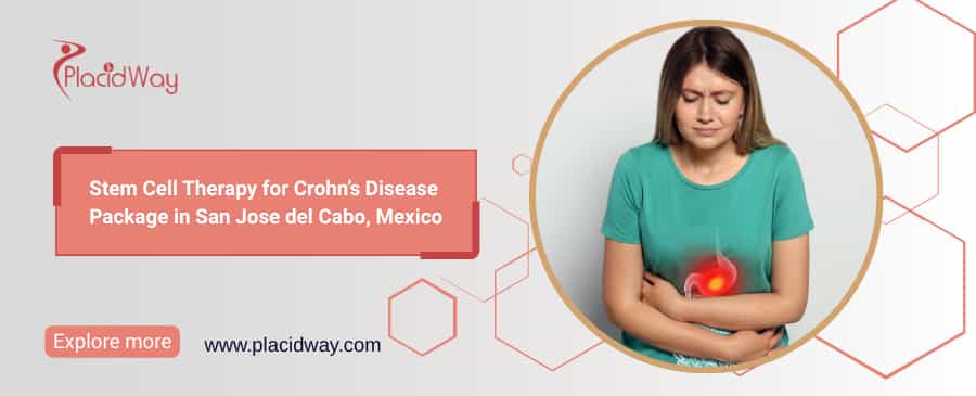 Stem Cell Therapy for Crohn’s in San Jose del Cabo