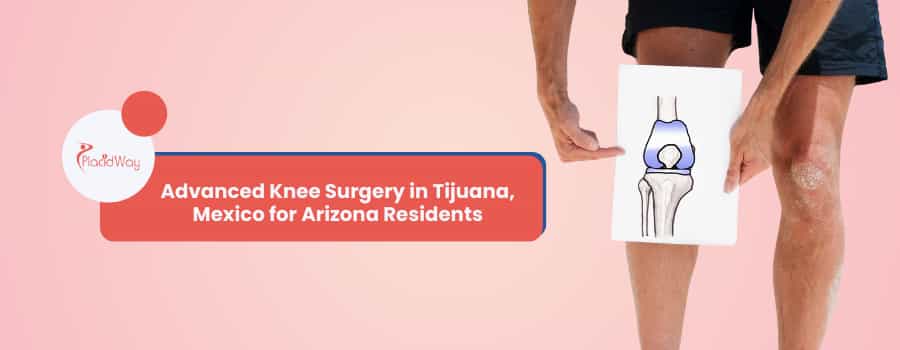 Advanced Knee Surgery in Tijuana, Mexico for Arizona Residents