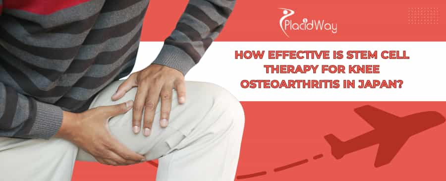 Stem Cell Therapy for Knee Osteoarthritis in Japan