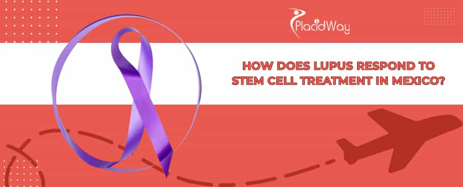 Lupus Stem Cell Treatment in Mexico