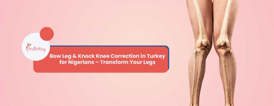 Bow Leg & Knock Knee Correction in Turkey for Nigerians – Transform Your Legs