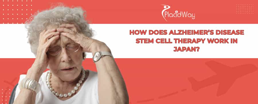 Alzheimer’s Stem Cell Therapy in Japan
