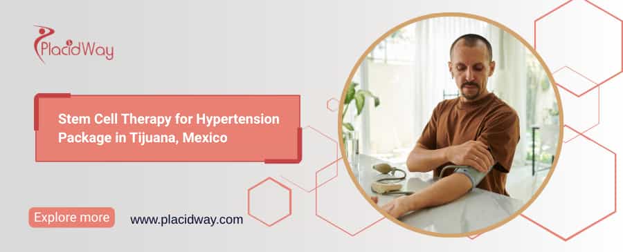 Stem Cell Therapy for Hypertension in Tijuana, Mexico