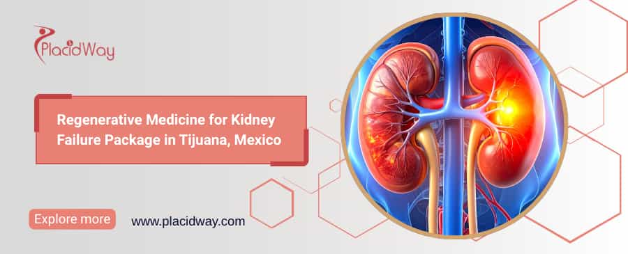 Stem Cell Therapy for Kidney Failure in Tijuana, Mexico