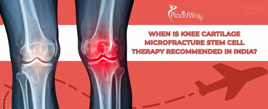 Knee Stem Cell Microfracture Therapy in India