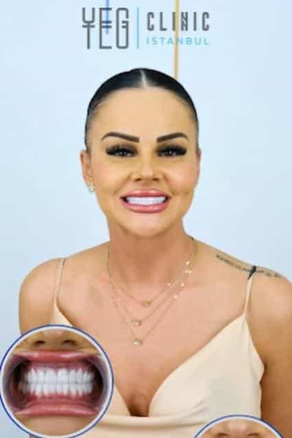 Dental Treatment in Istanbul Testimonial